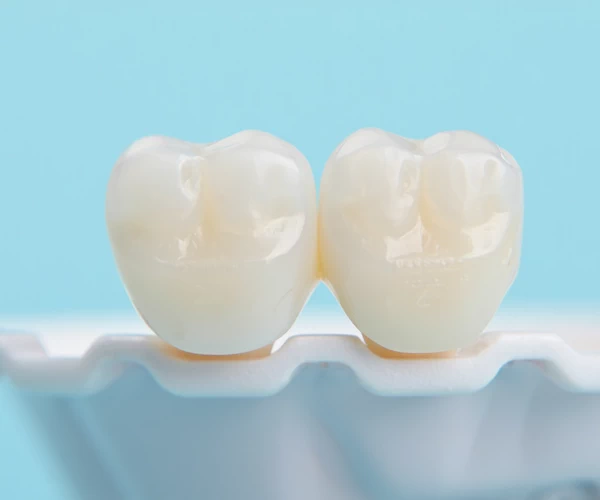 Dental Crowns in Fairfax
