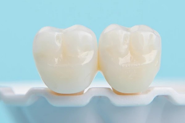 Dental Crowns