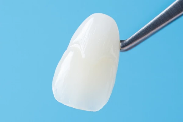 Porcelain Veneers