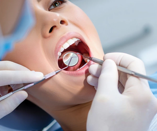 Root Canal Fairfax