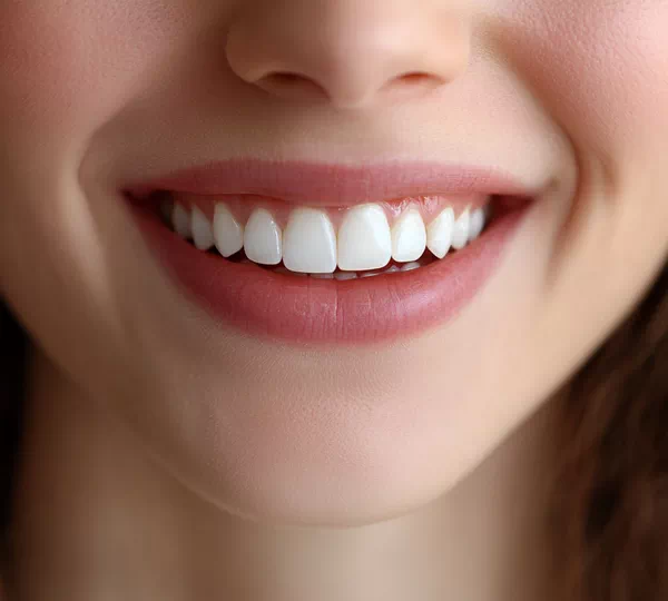 Teeth Whitening Fairfax
