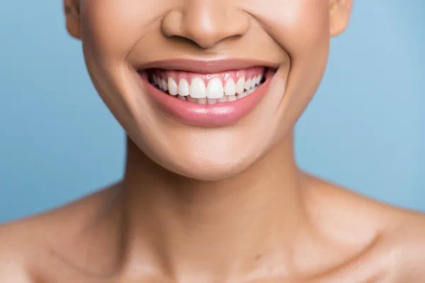 Teeth Whitening