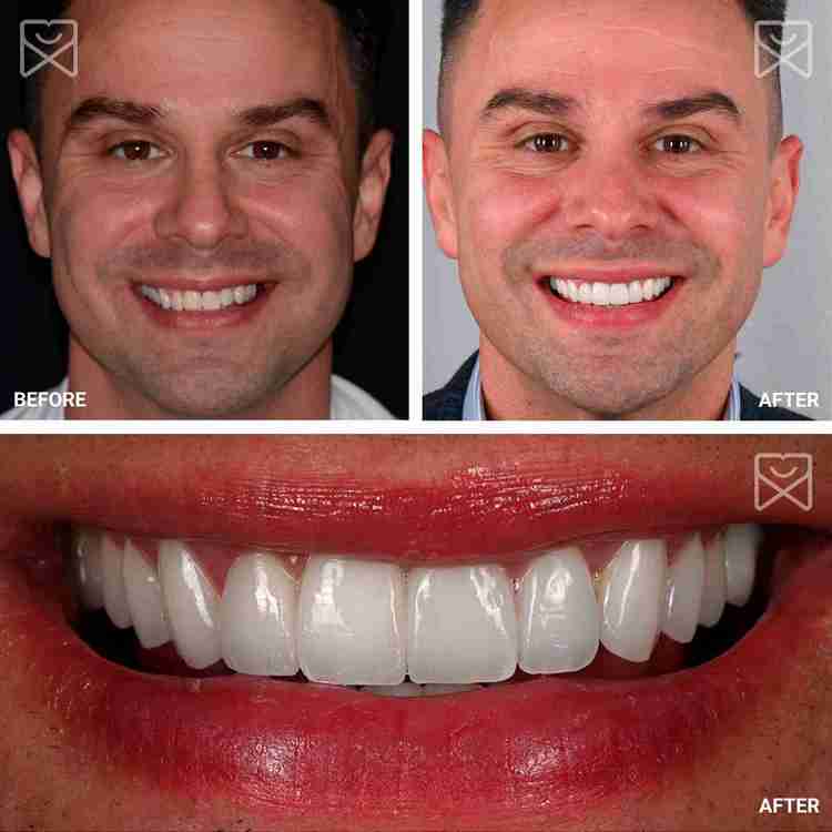 Cosmetic Dentistry in Fairfax