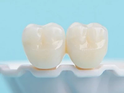 Dental Crowns