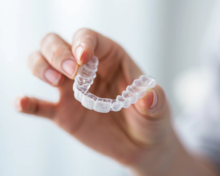 Invisalign in Fairfax