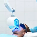 In-Office Power Whitening